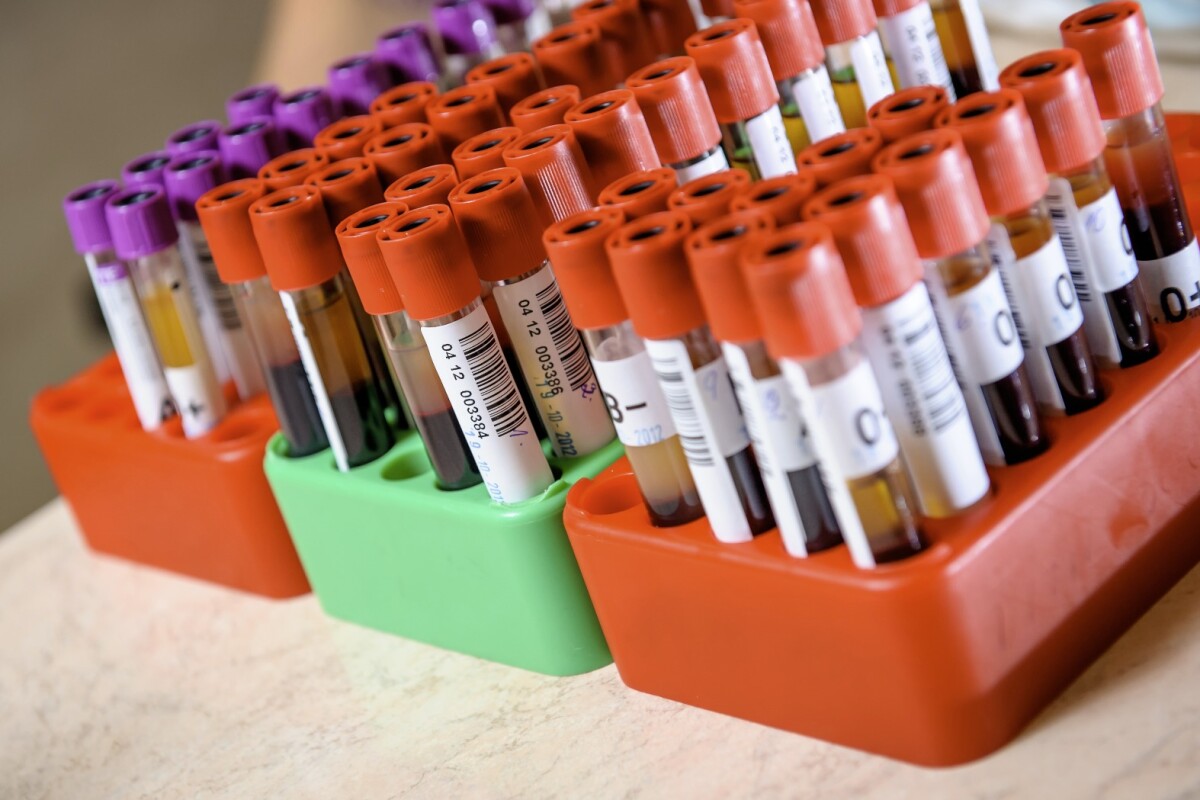 A new study reveals a potential new diagnostic tool that could allow doctors to identify whether a child is on the autism spectrum through a simple blood test