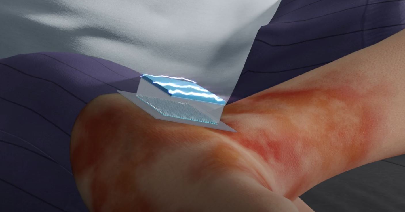 The chip can be applied directly to the damaged area