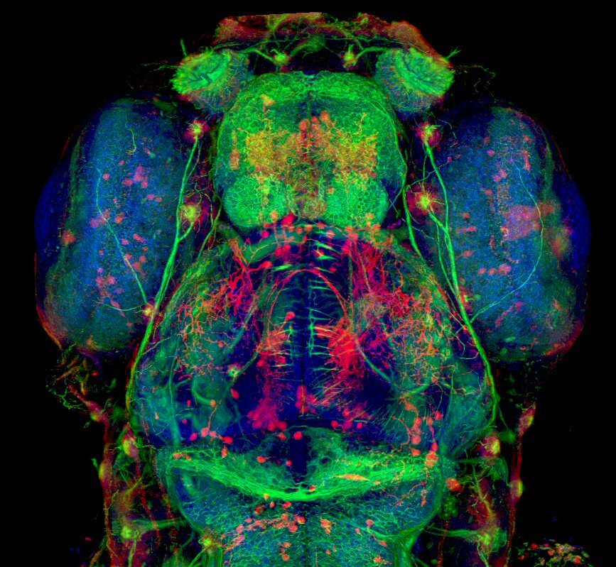 2nd PlaceDr. Hideo OtsunaUniversity of Utah Medical Center, Department of Neurobiology and AnatomySalt Lake City, Utah, USA5-day old zebrafish head (20x)