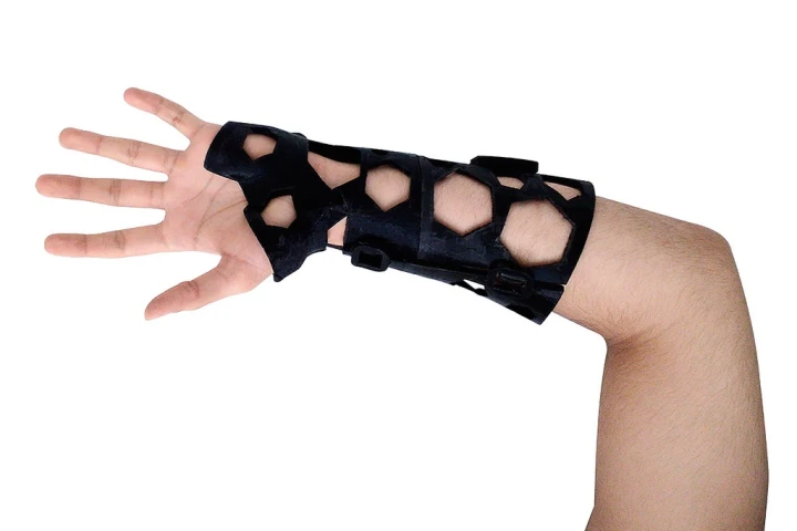 Unlike a plaster cast, the NovaCast is lightweight, well-ventilated and waterproof