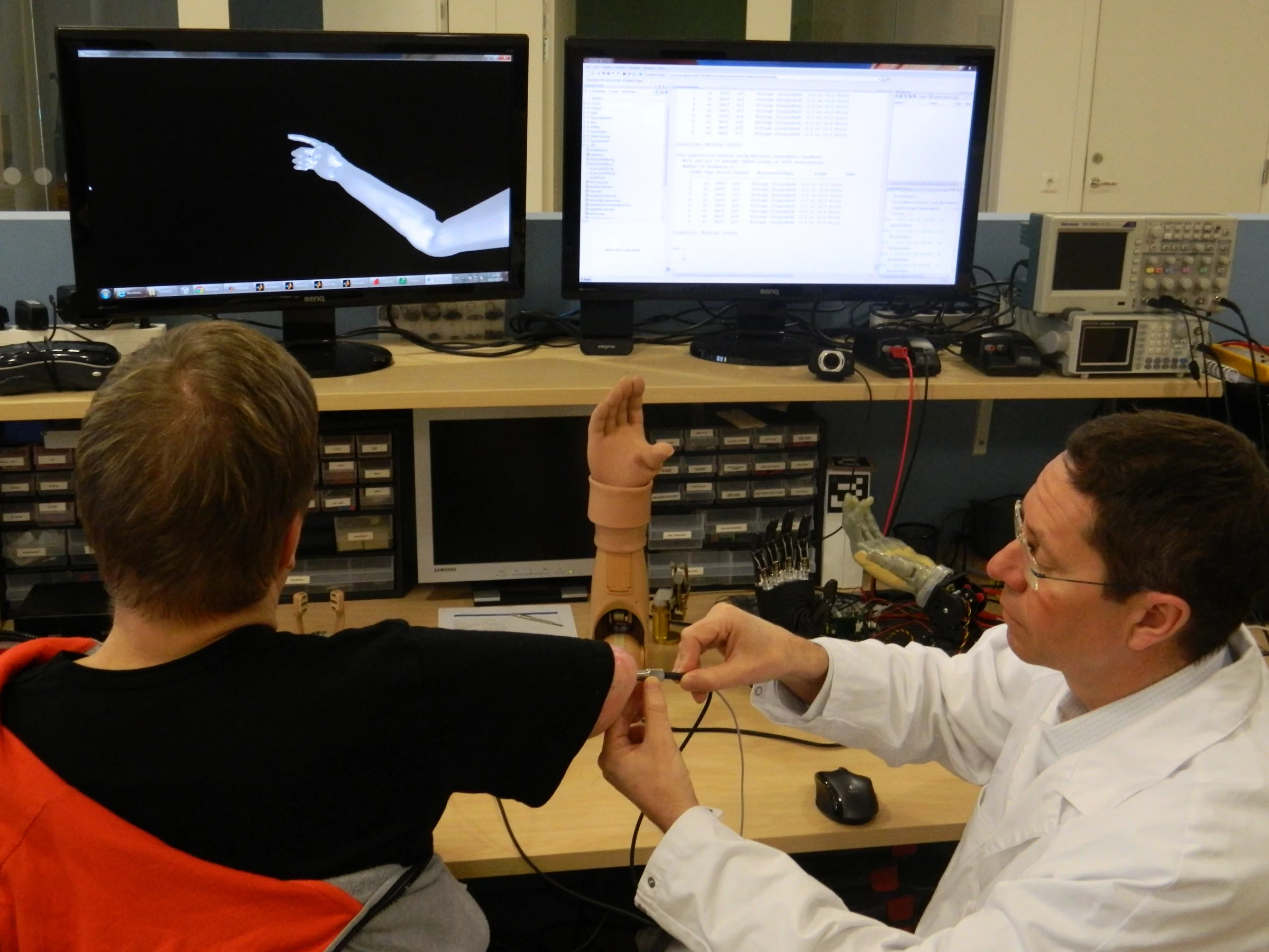 Dr Rickard Brånemark tests the functionality of the world's first muscle and nerve controlled arm prosthesis permanently implanted in an amputee