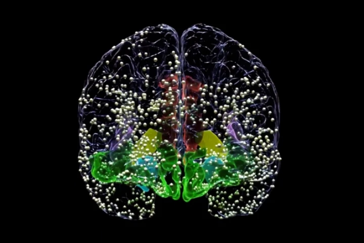 All the above dots represent the locations where electrodes were temporarily implanted as part of new research into the use of DBS to treat depression