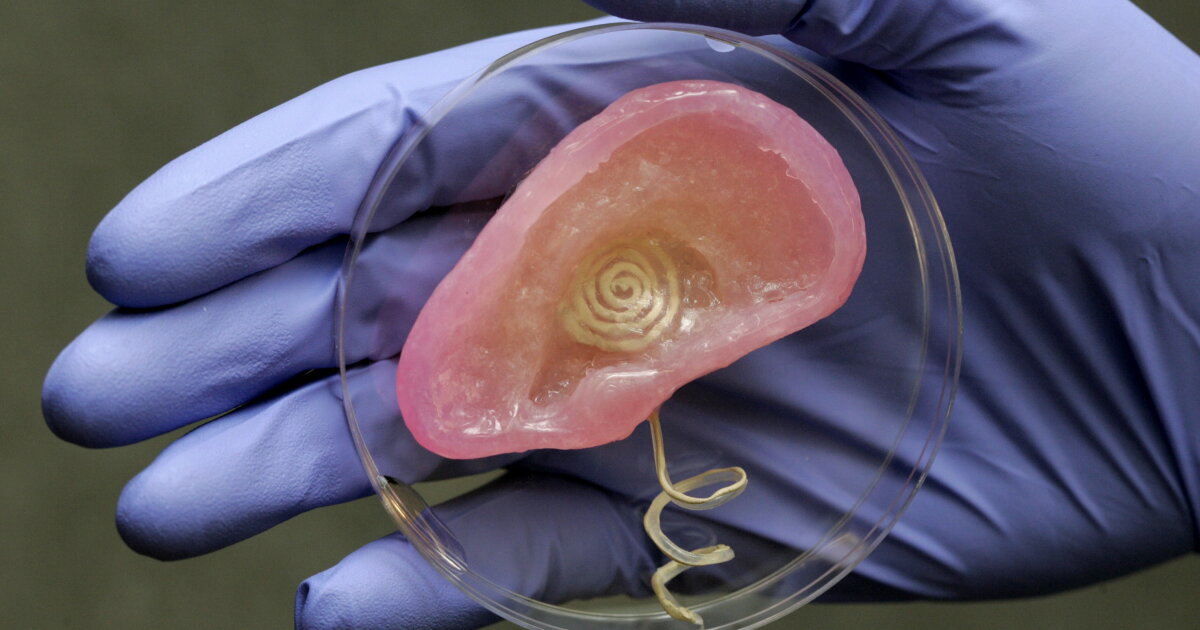 Bionic Ear System Scientists create 3D-printed bionic ear that can