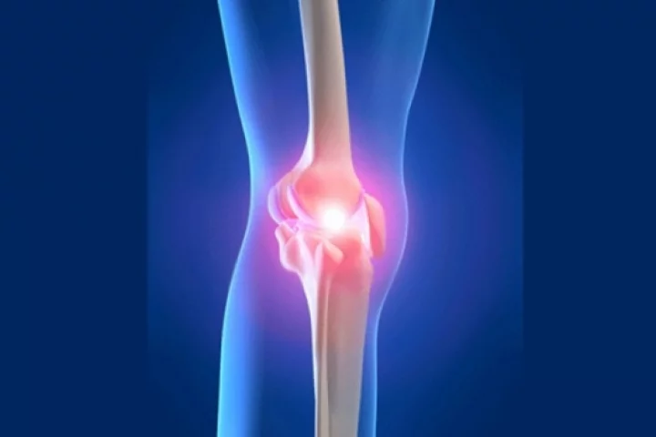 The new scaffold mimics bone and cartilage when implanted into a joint