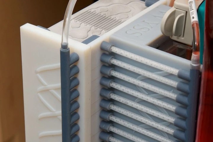 Harvard's spleen-on-a-chip blood filtration device