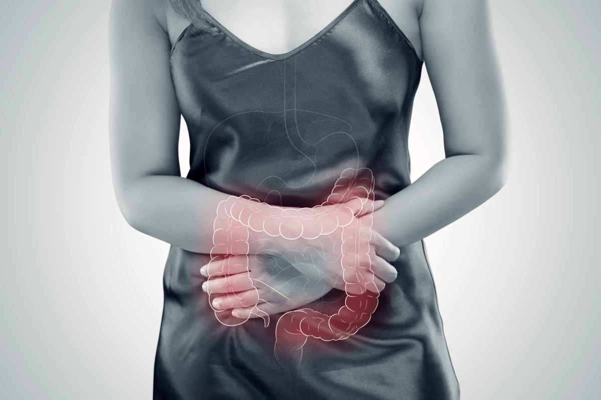 A new study suggests a genetic relationship between depression and susceptibility to peptic ulcer disease