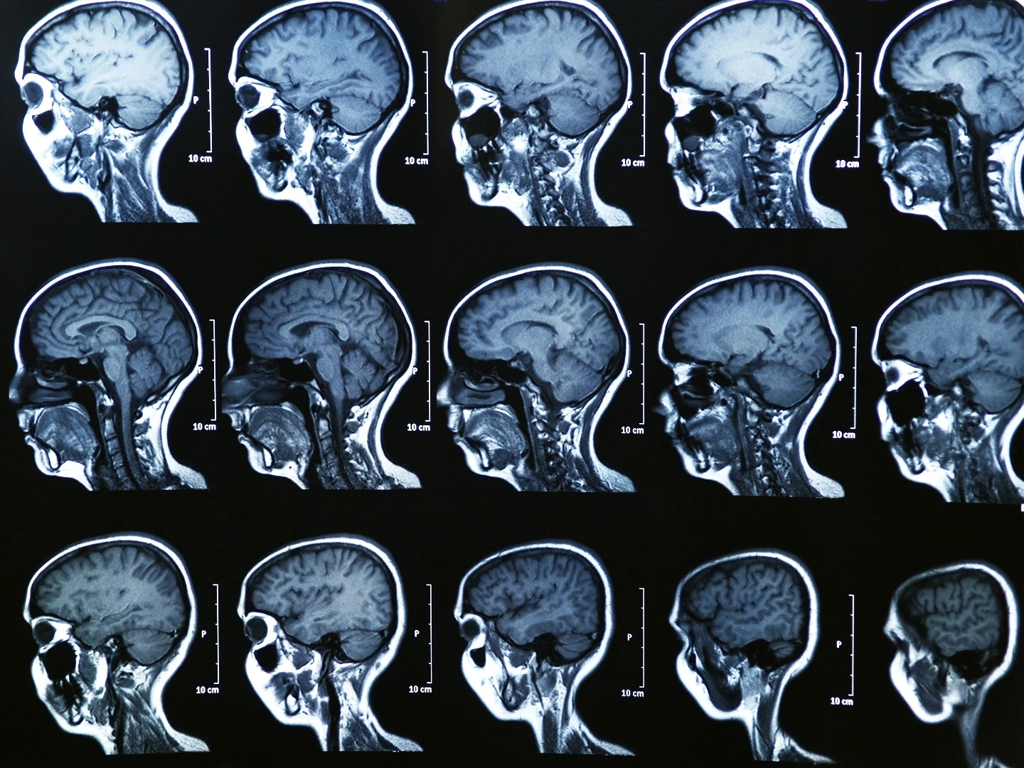 Brain scans could help scientists and lawyers determine a suspect's criminal intent