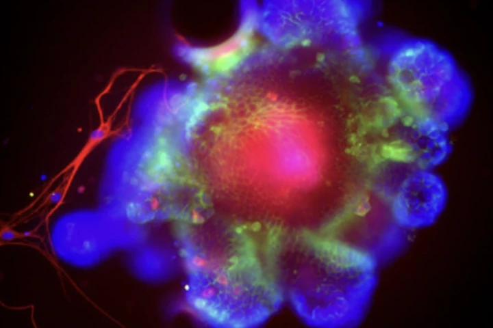 This micrograph shows a small intestine organoid, which helped UC San Diego researchers identify a new mechanism driving alcoholic liver disease