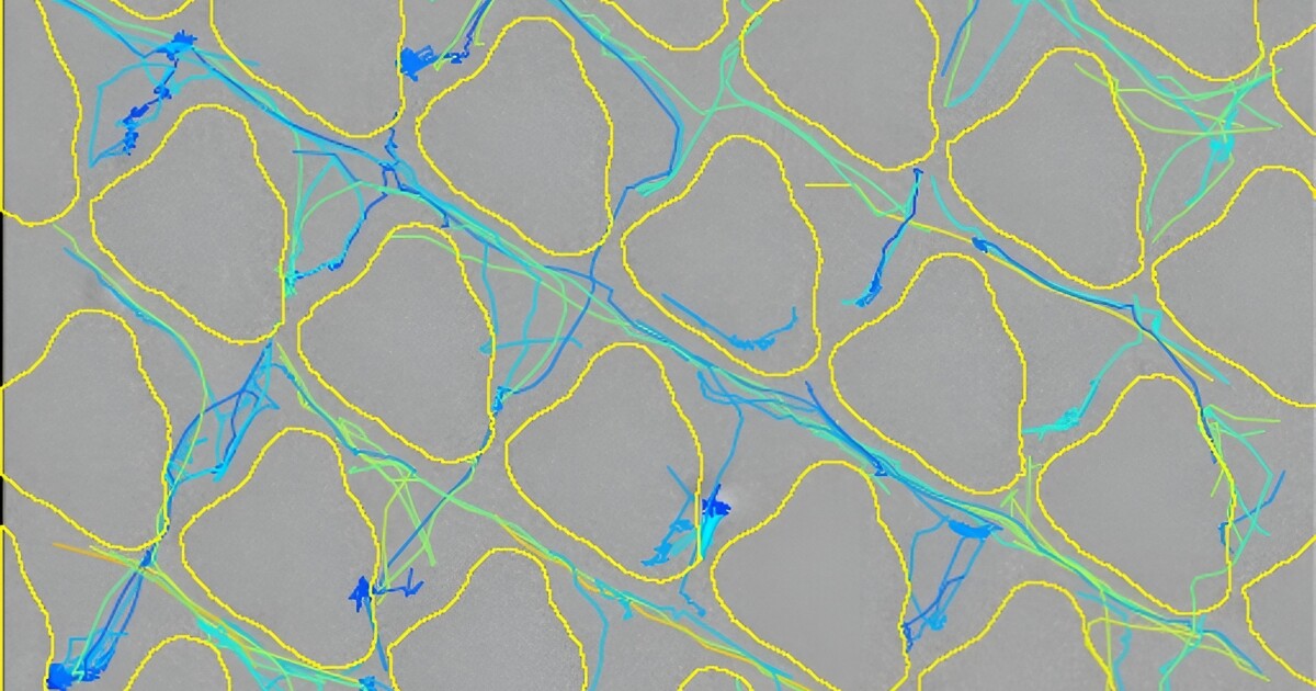 Embossed patterns reduce infection risk on medical devices Embossed patterns reduce infection risk on medical devices