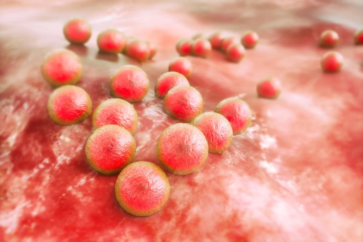 In testing, the Kisameet clay was able to kill of 16 dangerous bacteria, including MRSA (pictured)