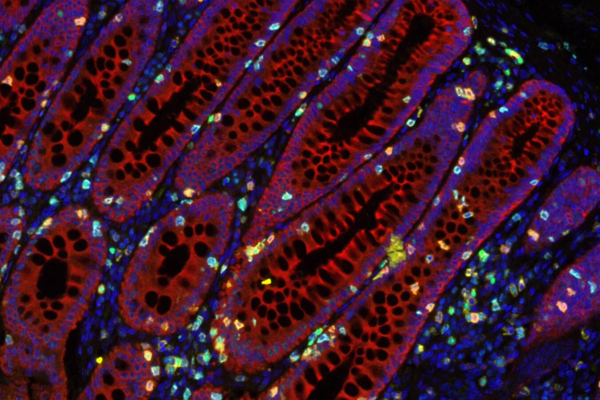 The discovery could help vastly improve patient outcomes and survival rate for cancer sufferers