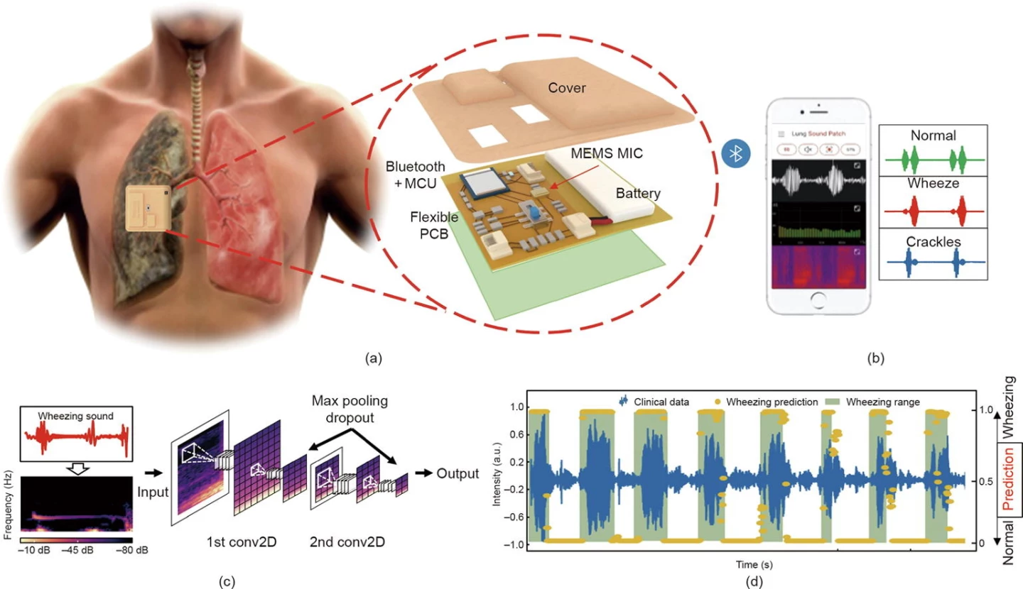 A diagram of the LSMP, which was actually worn on the test subjects' backs for the study