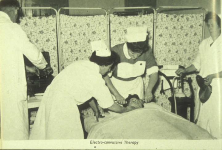 Electroconvulsive therapy in 1957 (Credit: University of Liverpool Flickr / CC BY-SA 2.0)