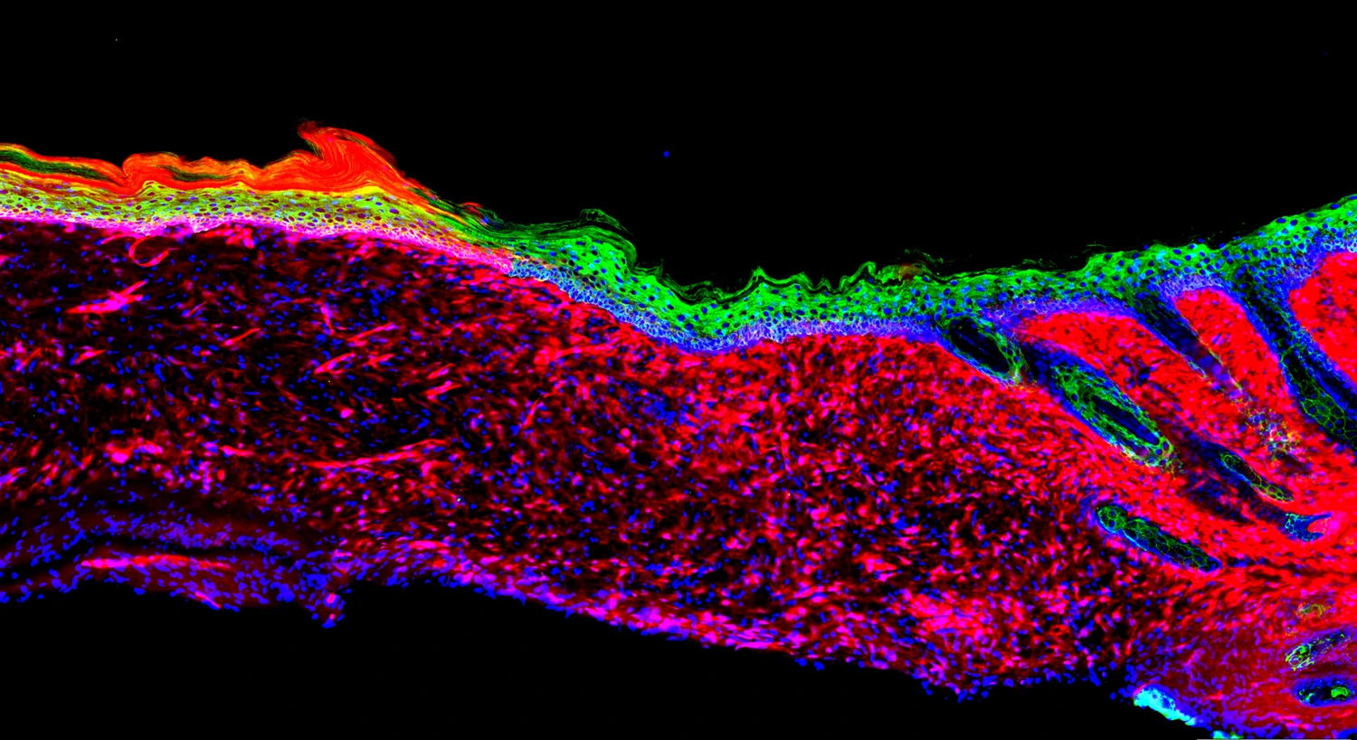 Salk Institute scientists converted one type of cell (seen in red) into basal keratinocytes (green), a precursor to healthy skin cells