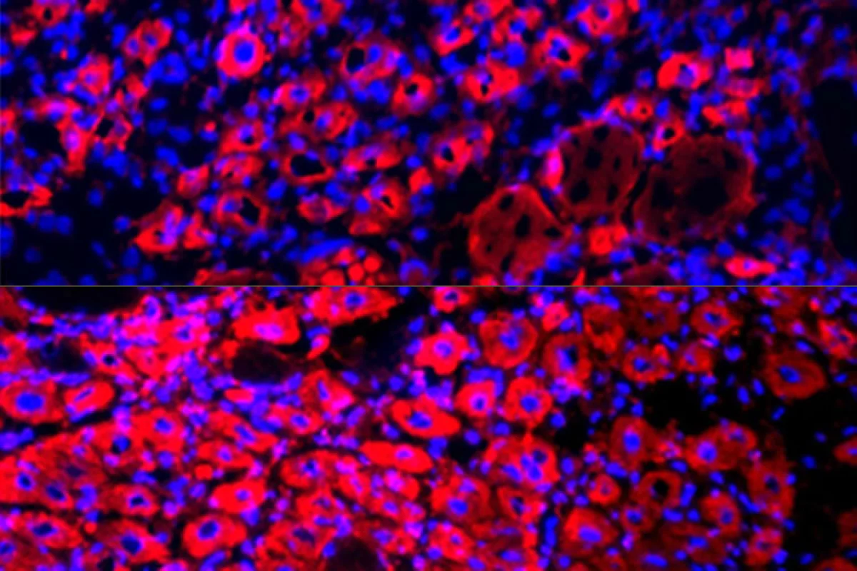Older mice exhibited many more new muscle fibers (seen as the pink “donut” shapes), after undergoing a blood plasma dilution procedure (bottom)