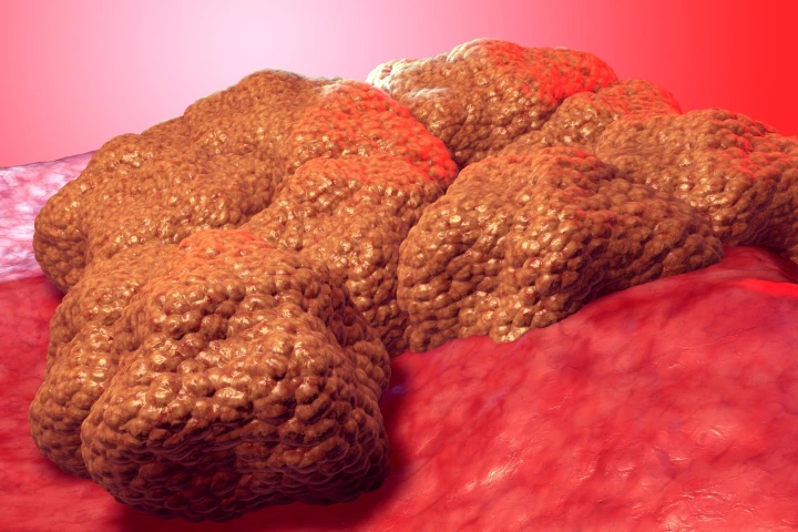 Researchers at Northwestern University have developed a way to trigger an ancient cancer "kill switch" hidden in our genes