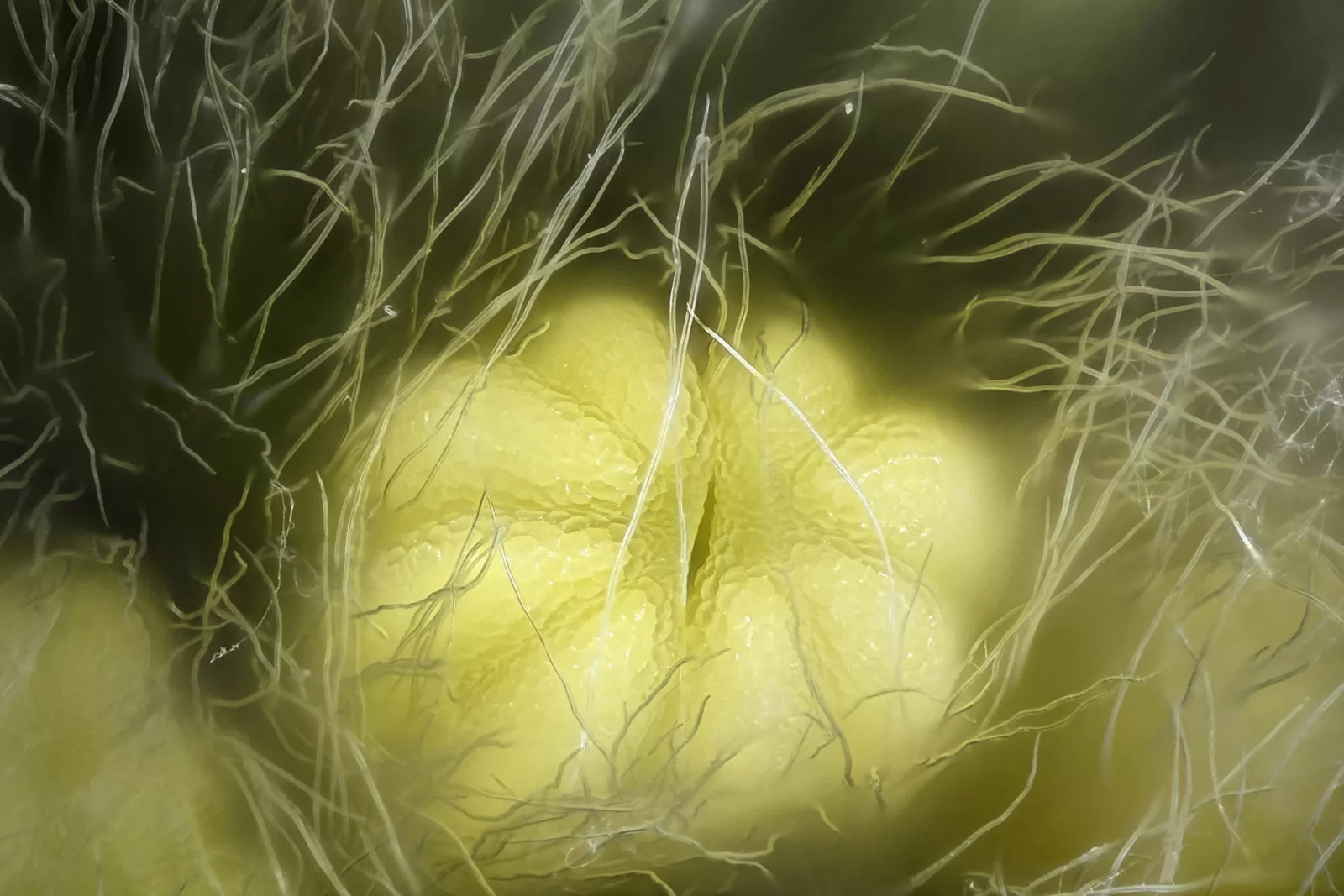 Image of Distinction: The stamen of a tea-leaved willow