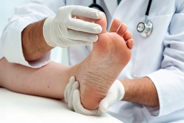 Measuring water loss from the skin can predict the return of a diabetic foot ulcer