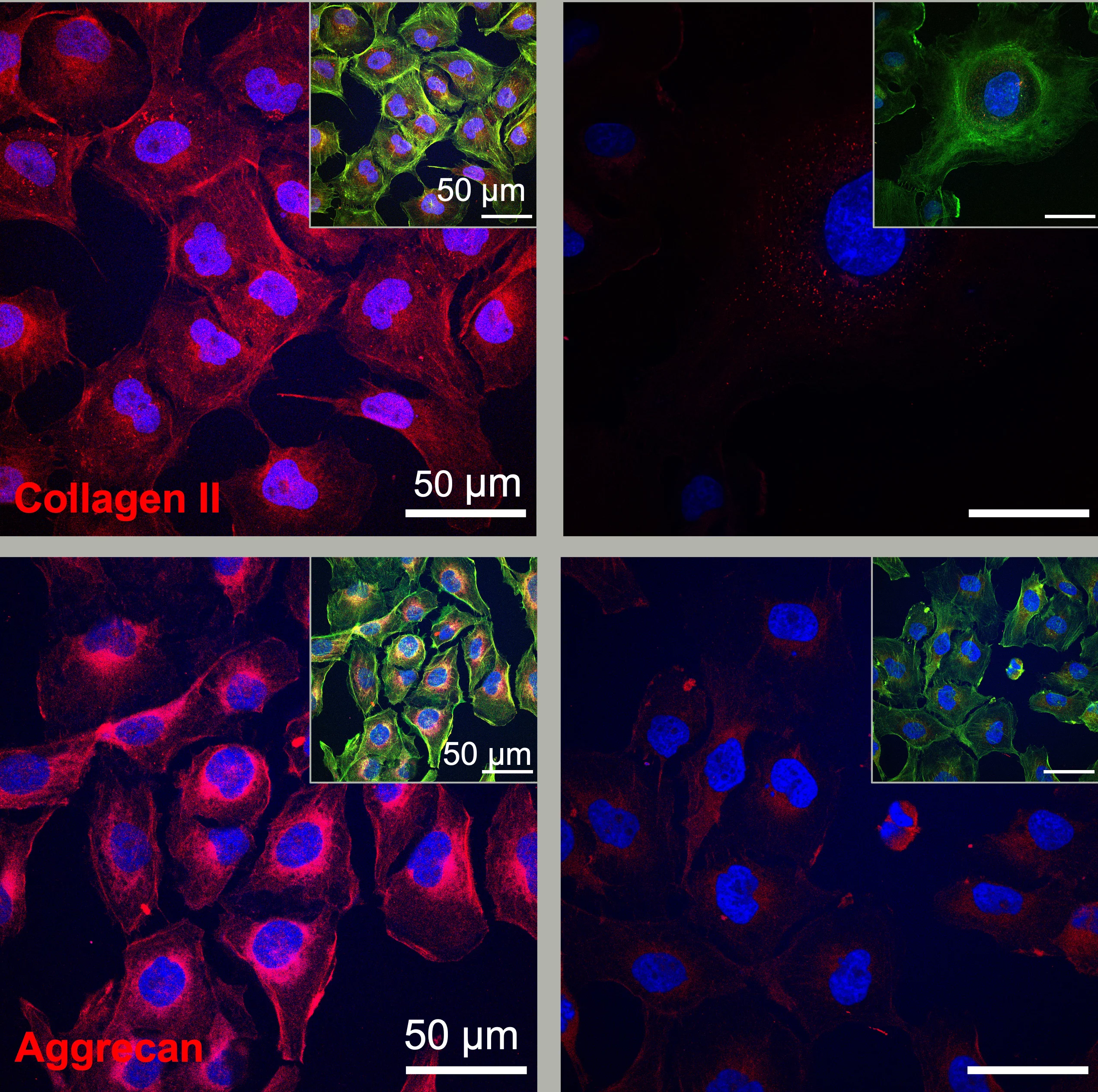 Cartilage cells generate more protein components (collagen II and aggrecan) for regeneration when treated with fast-moving dancing molecules (left) compared to slower moving molecules