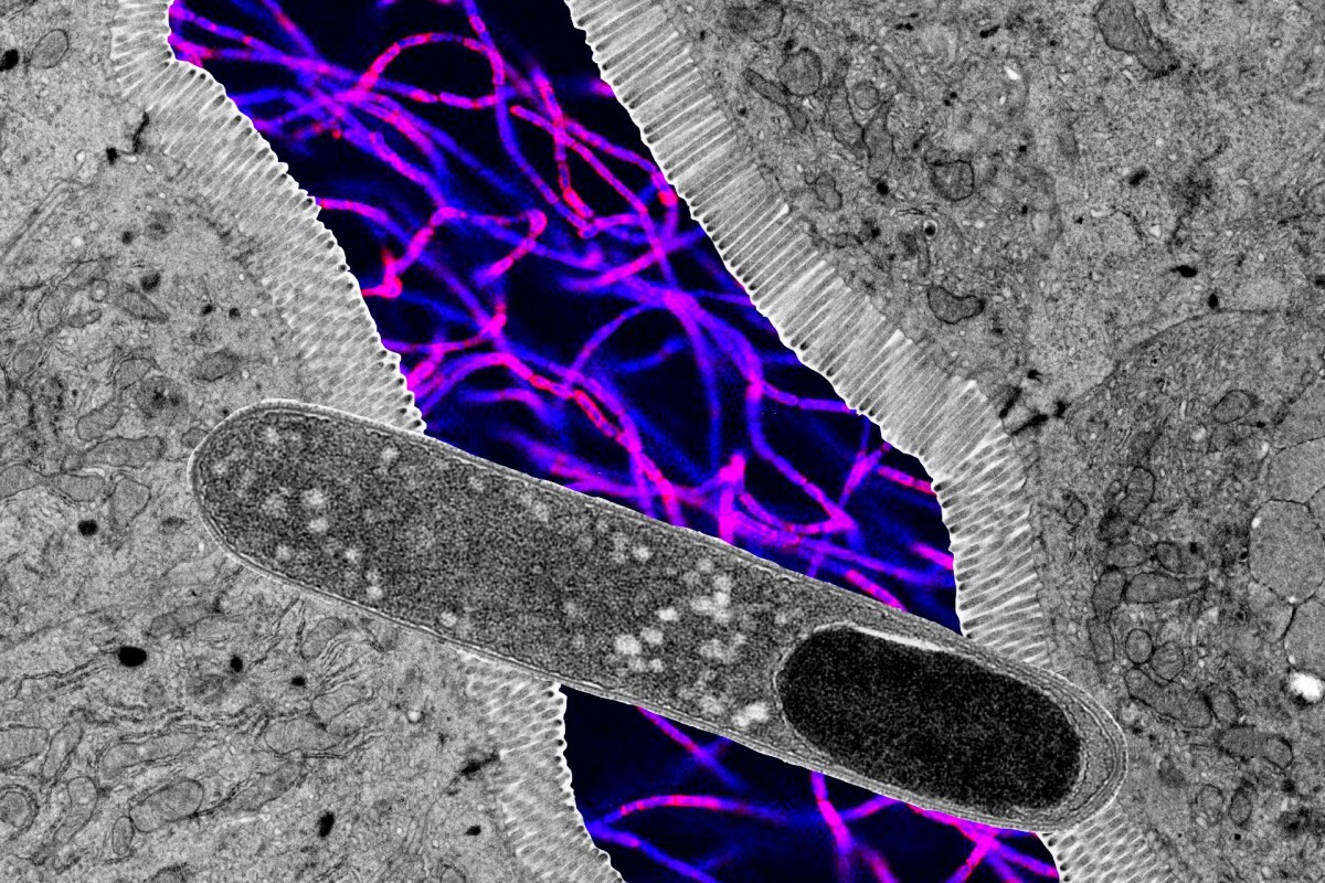 Weight gain single-handedly prevented by a gut microbe