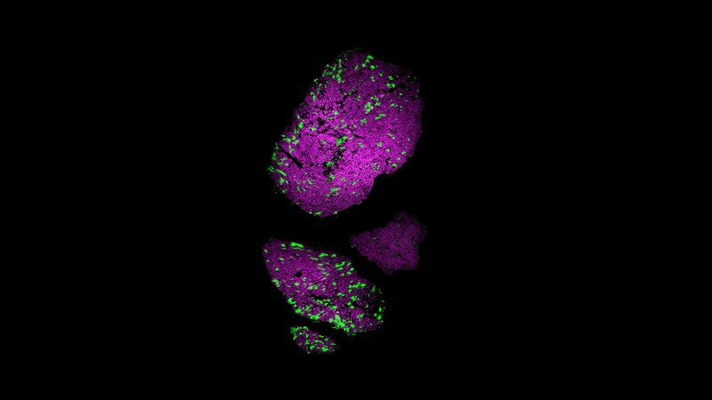 The ability to modify pain sensitivity is based on the use of light-sensitive proteins, or opsins
