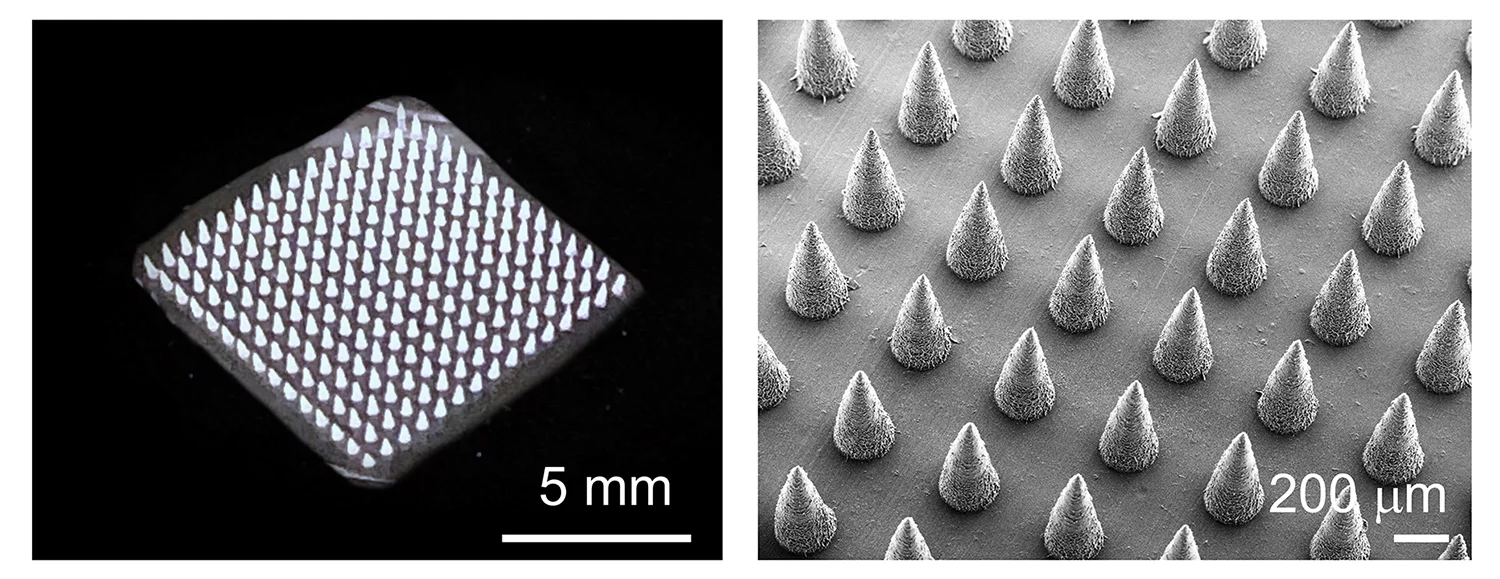 There are hundreds of microneedles on a single patch
