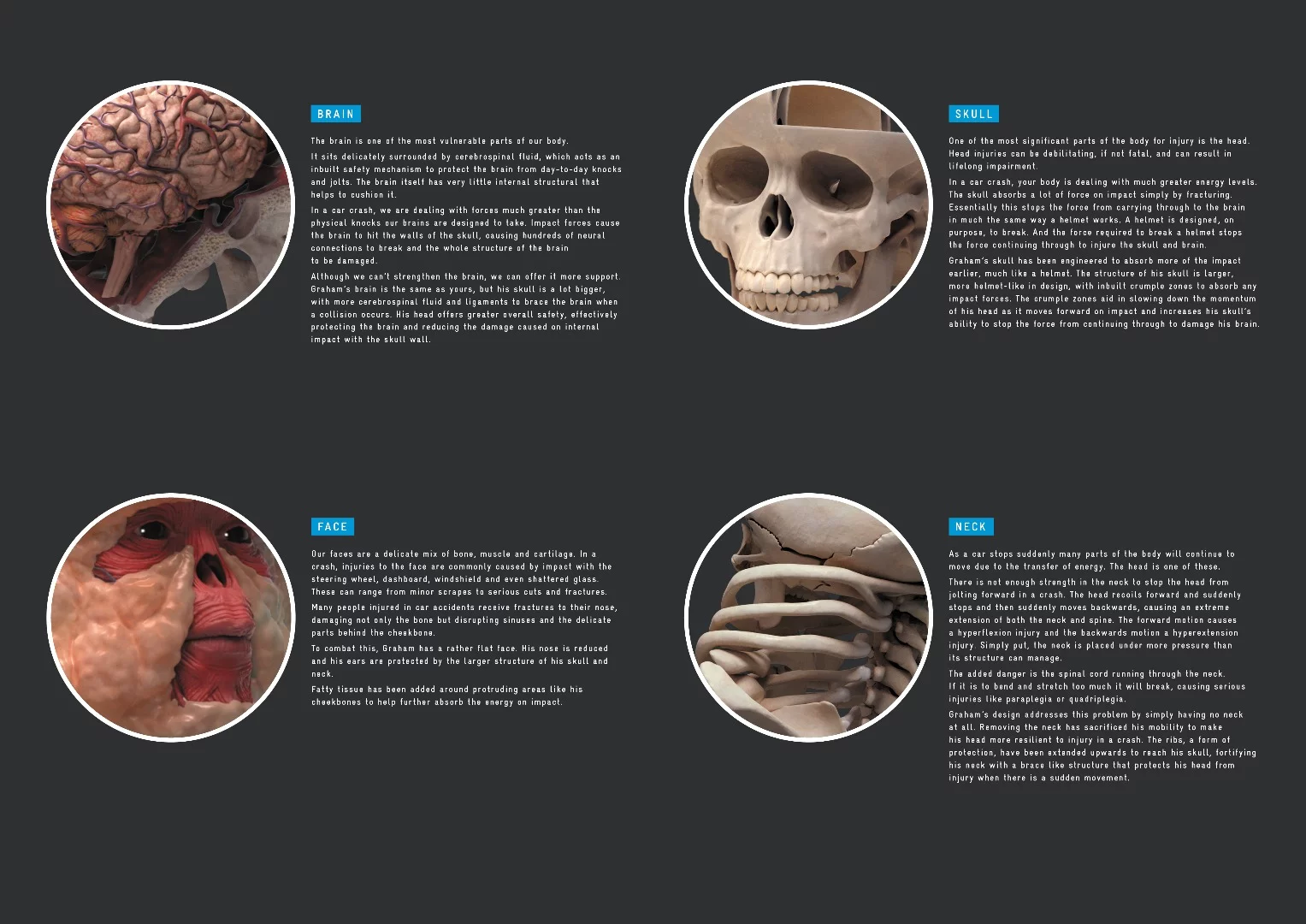 The thinking behind Graham's "choice" modifications