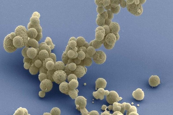 An electron microscope image of JCVI-syn3B, a synthetic lifeform designed to have the smallest genome of any known organism, at just 493 genes