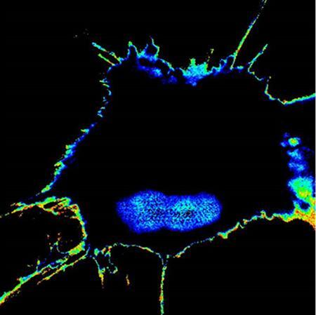 A tumor cell that has acquired high metastatic potential during chemotherapy lights up with high FRET biosensor readout, whereas the cells that are sensitive to chemotherapy (and hence, low potential) stays dark