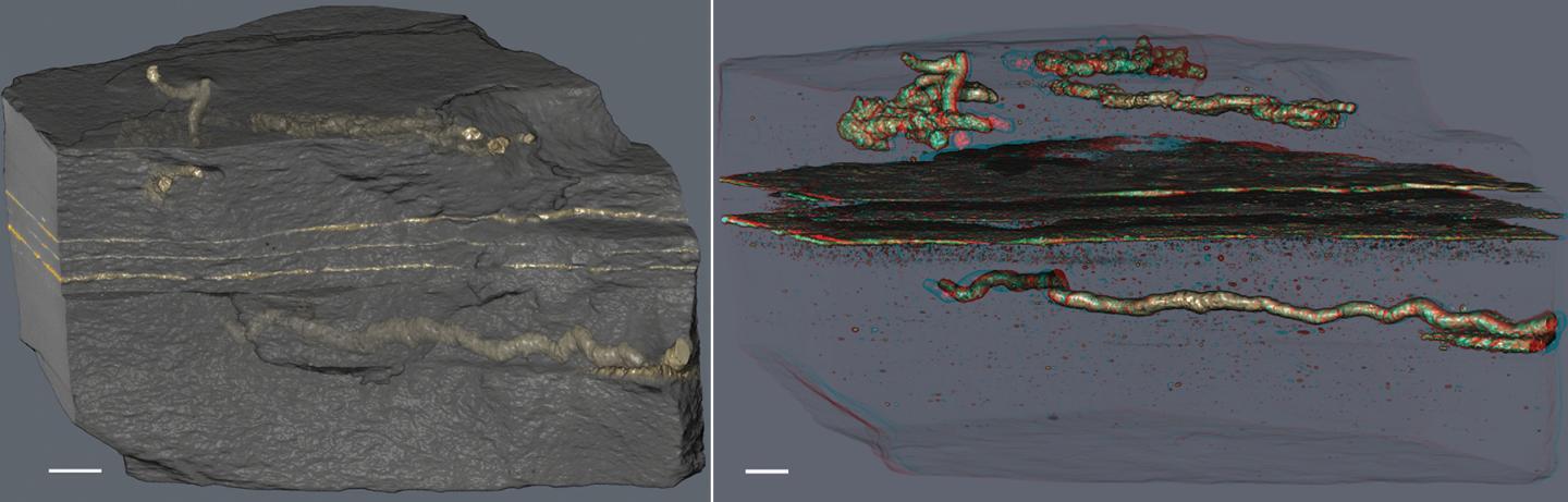 3D images show the tubes in clear detail
