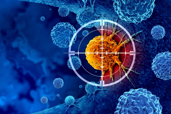 Researchers have developed a gel drug-delivery system to treat solid cancer tumors