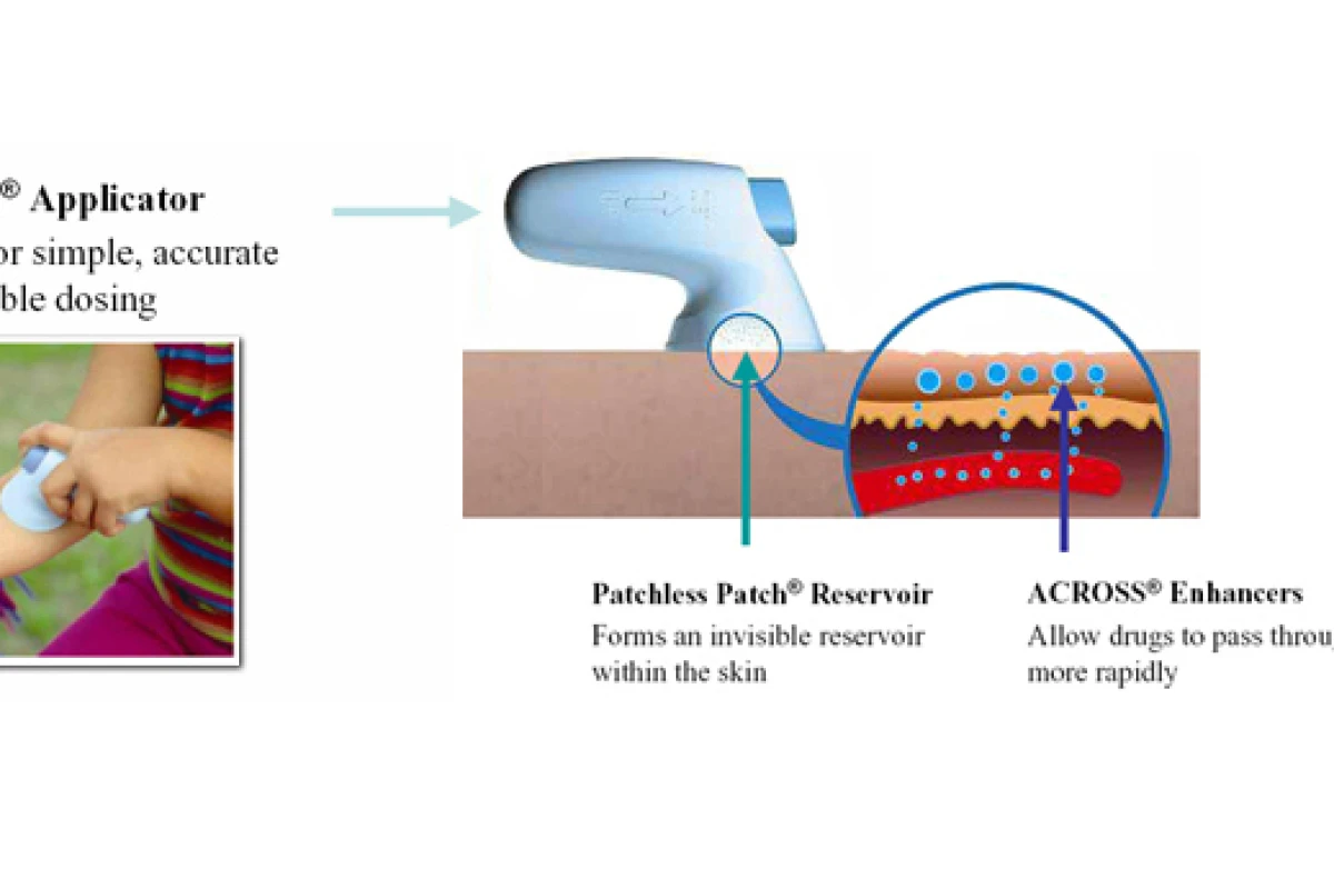 The pilot study on the effect of restoring testosterone levels in older women used a novel method of testosterone application - the MDTS Applicator (Image: Acrux)
