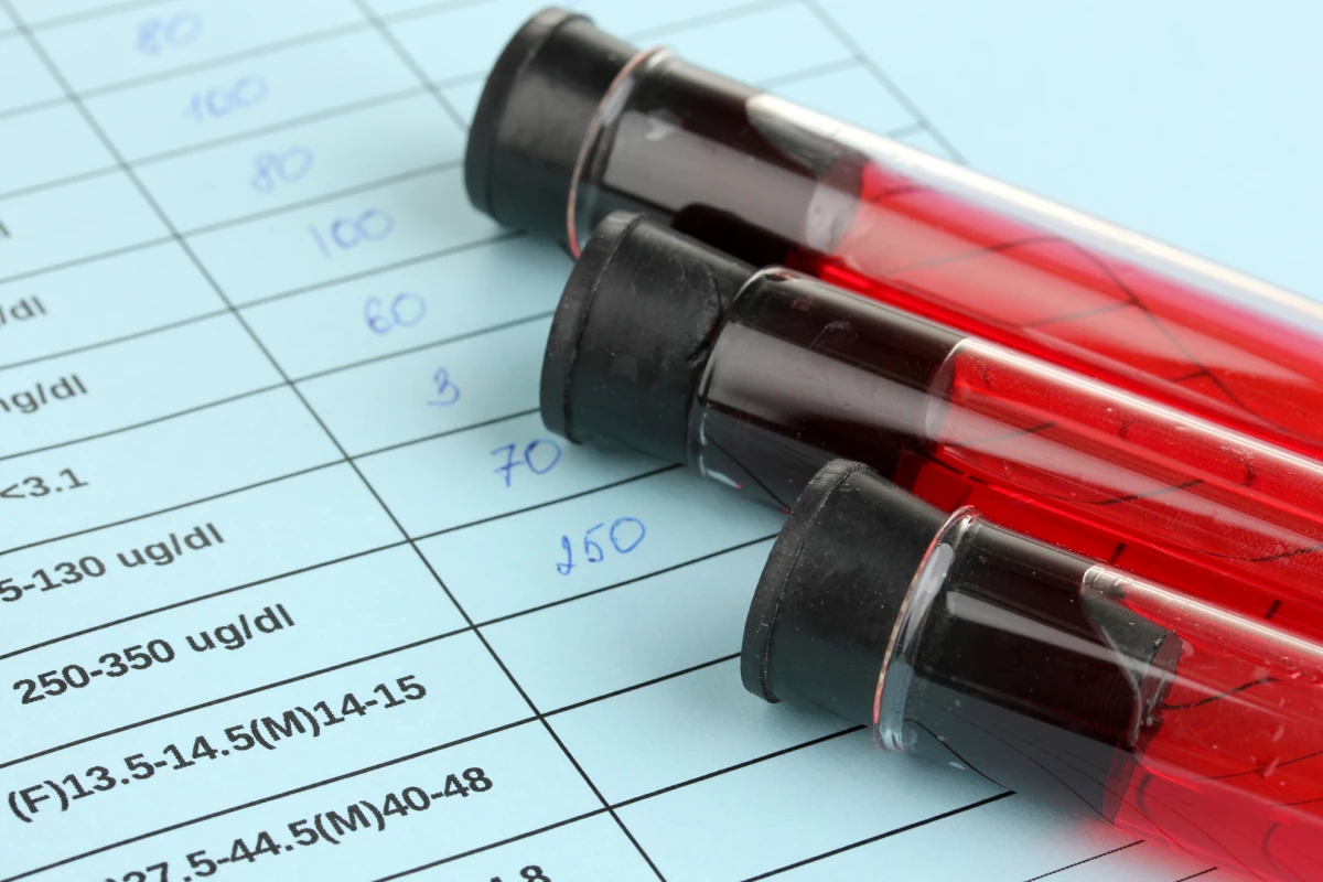 A blood test can detect DNA fragments from brain tumors circulating in a patient's bloodstream