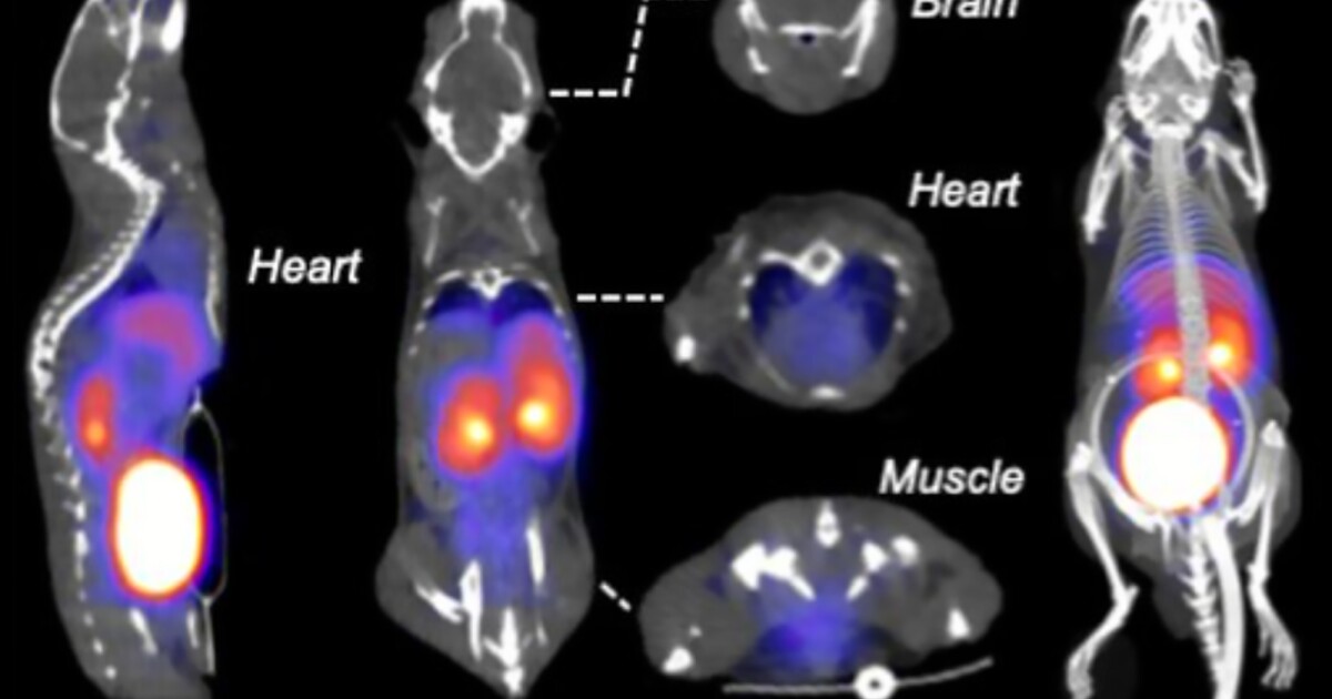 Radioactive ‘fruit sugar’ lights up cancer and inflammation Radioactive ‘fruit sugar’ lights up cancer and inflammation