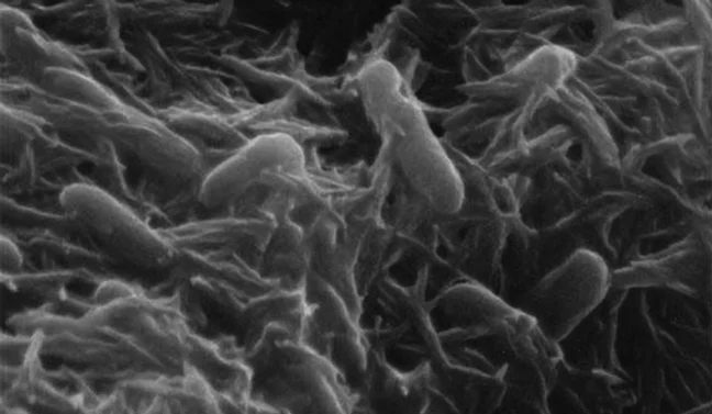 Shewanella bacteria, which produces ketones that are processed into fuel(Image from 'Cultivating Bacteria's Taste for Toxic Waste')
