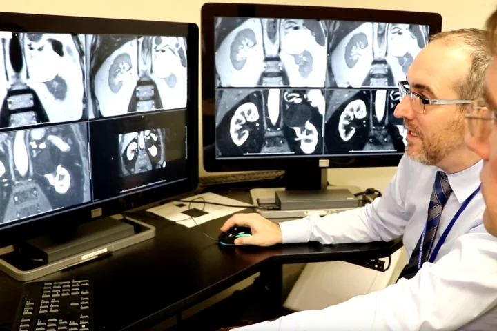 A new MRI method can confidently identify if a kidney tumor is malignant or benign without the need for a biopsy