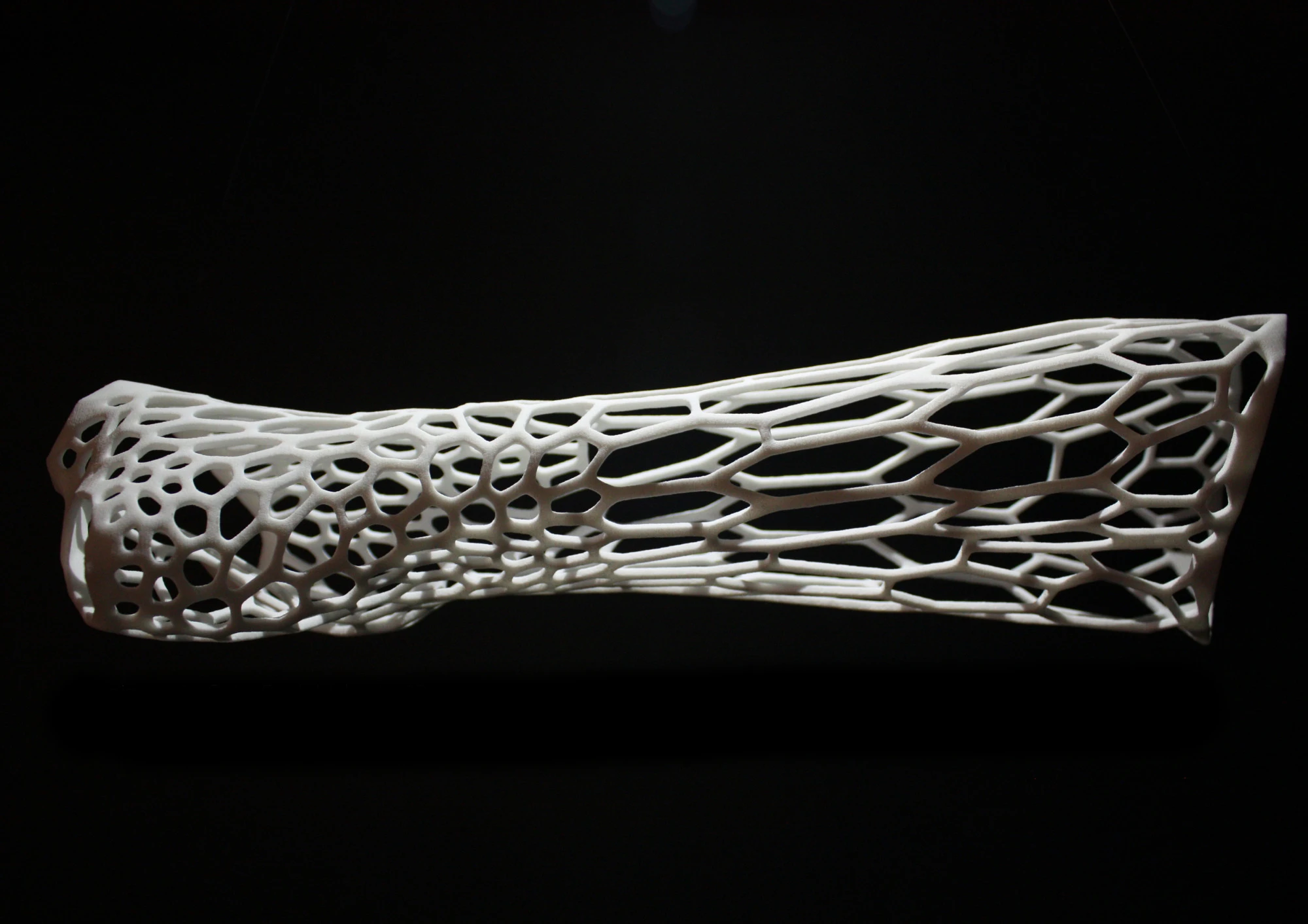 Jake Evill's Cortex concept uses 3D printing technology to create a bespoke exoskeletal cast