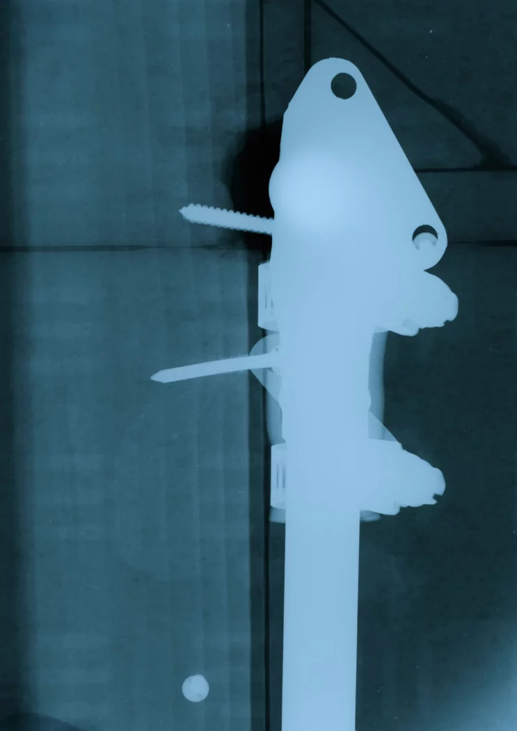 An X-ray of a wall in the artist's childhood home