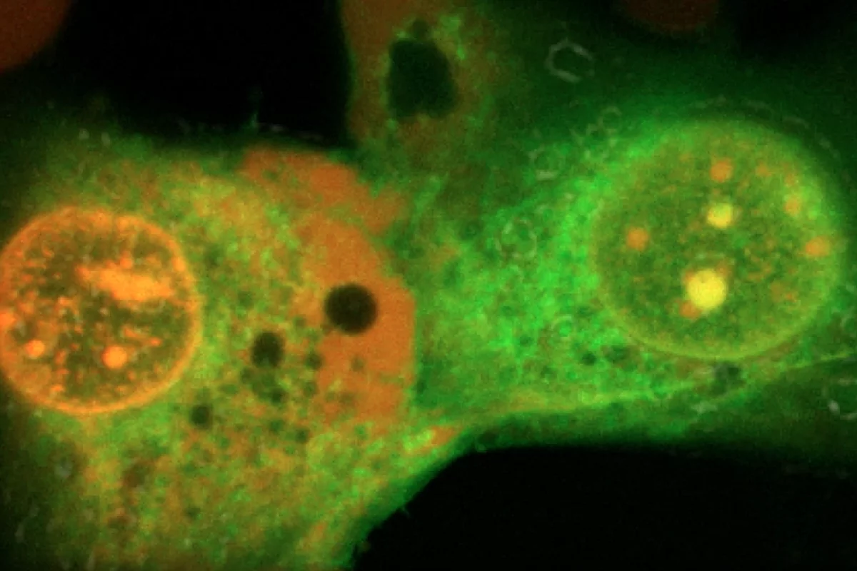 These tiny molecules can hunt down and kill specific cancer cells