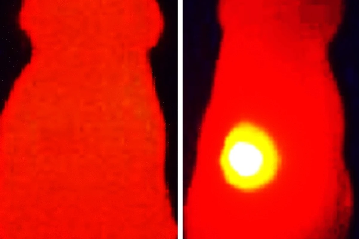 An infrared image of a tumor injected with melanin-loaded nanoparticles (right), compared to one that had just nanoparticles with no melanin (left)