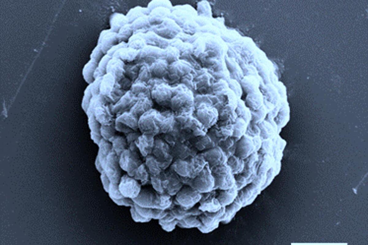 An image of a sugary droplet packed with hydrogen-producing algal cells