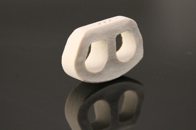 A 3D printed spine cage as enabled improved spinal fusion surgery