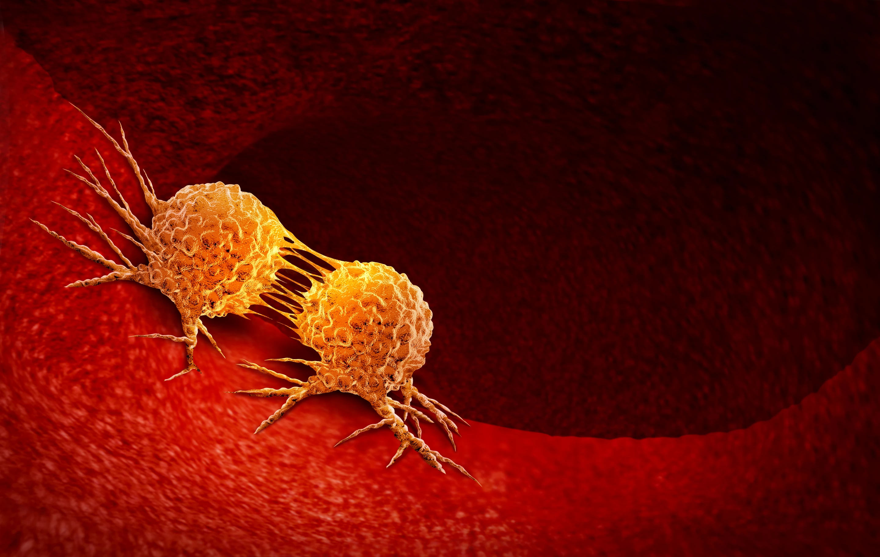 Men carrying the BRCA2 gene variant were twice as likely to develop prostate cancer compared to those without the mutation