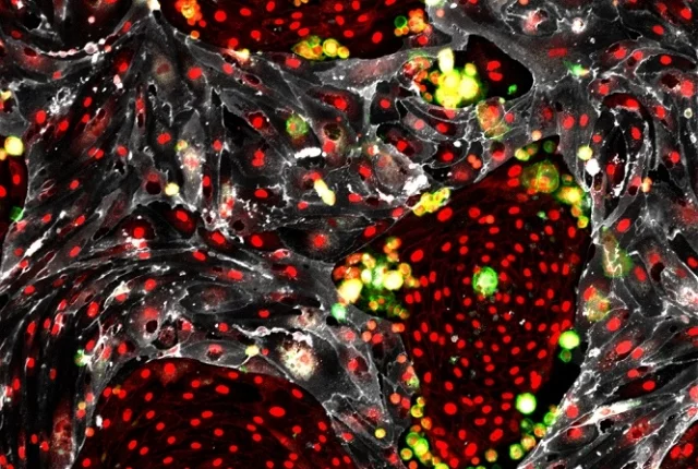 This image shows reprogrammed hematopoietic stem cells (green) that are arising from mouse cells