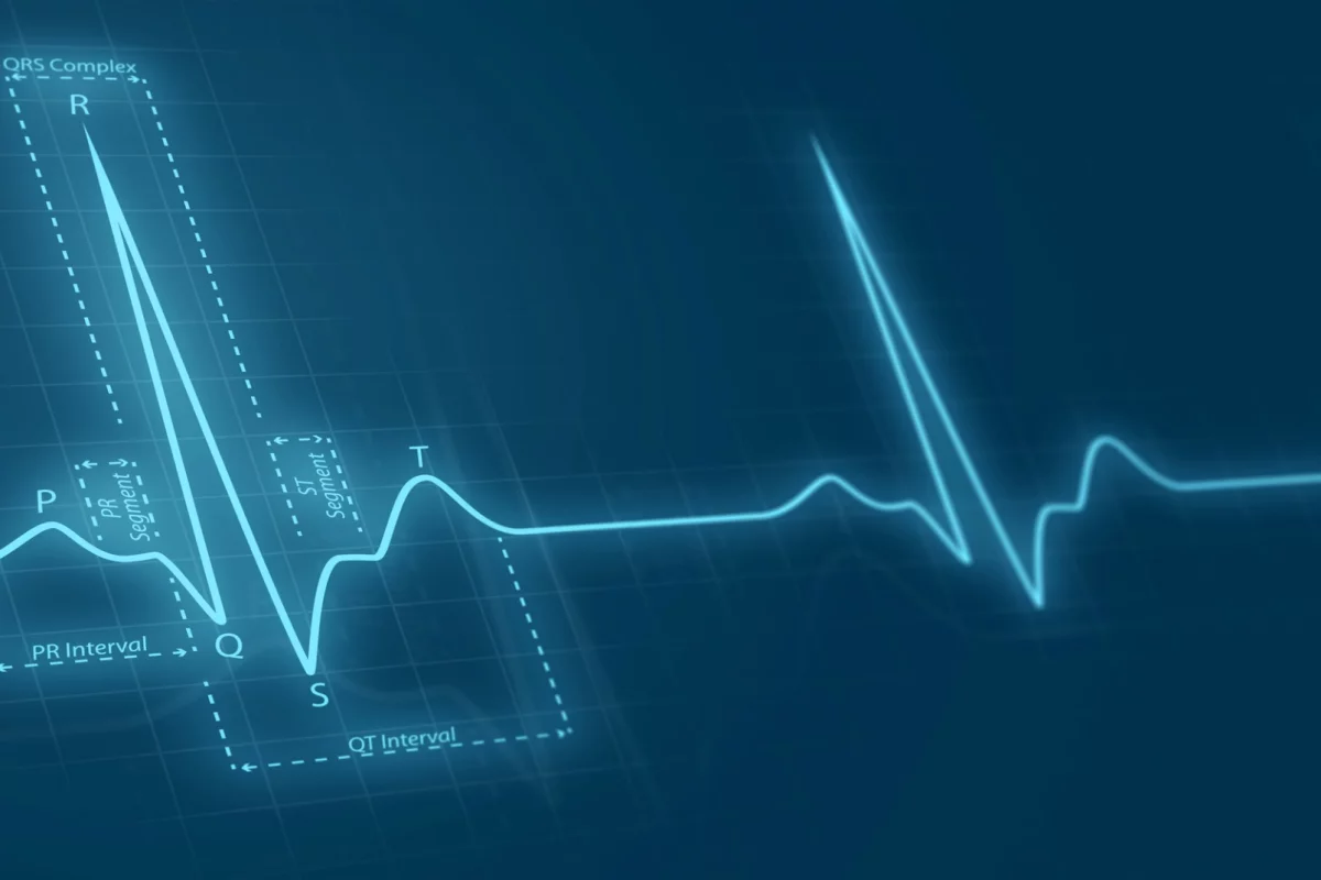 An AI system can effectively detect an early, pre-symptomatic stage of heart disease using simple electrocardiogram data