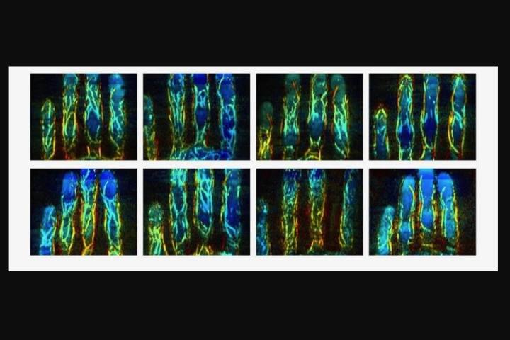 Finger vein images from eight separate people, with different colors representing different depths