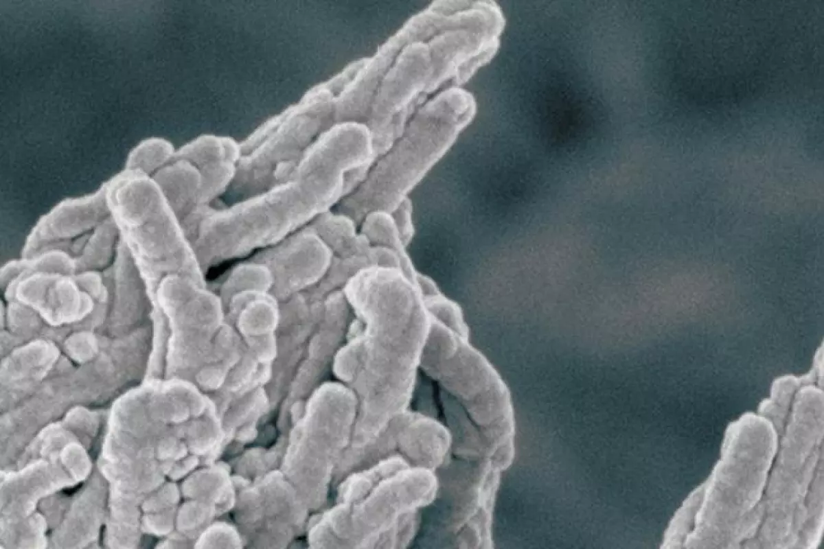 Uncovering the mechanism by which calcium deposits accumulate on the walls of arteries could help develop new treatments for everything from heart disease to dementia