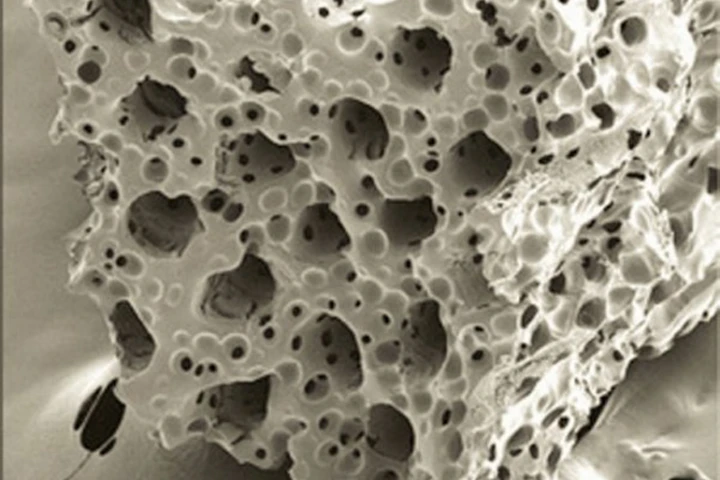 The scaffold is built out of a flexible, biocompatible material with pores that support the fragile cardiac cells and allow access to blood and nutrients (UW)