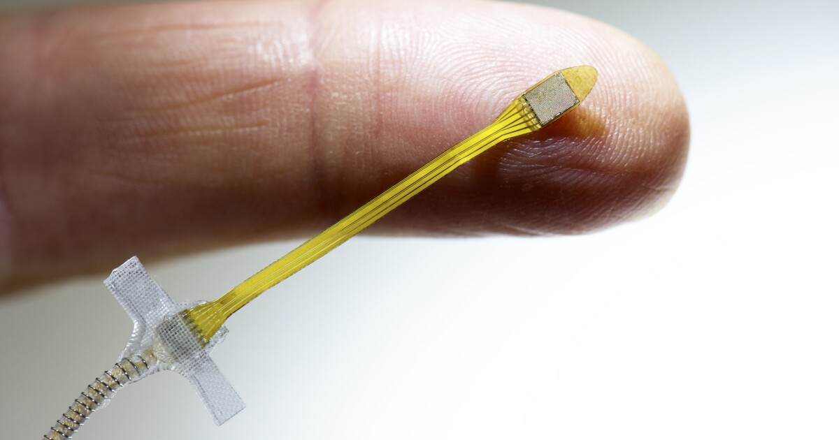 Retinal chip implant undergoes clinical trials