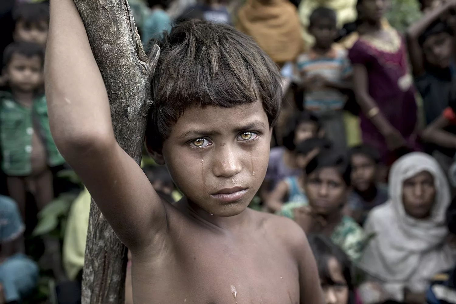 Winner of Photo of the Year. In Cox’s Bazar, Asmat Ara looks clearly traumatized after the recent violence which took place in Myanmar, on September 6th, 2017. The previous night she had entered Tenkhali Rohingya refugee camp with her family from Kumar Khali, Myanmar Rohingya state